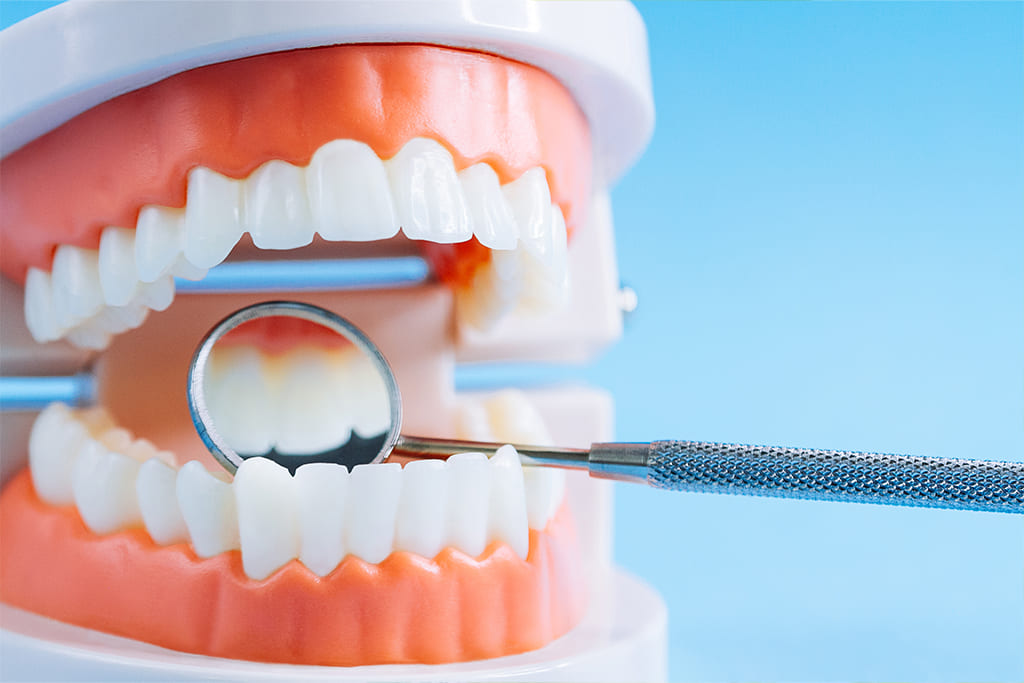 予防歯科のイメージ